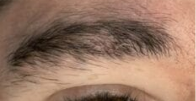 Before BrowBro