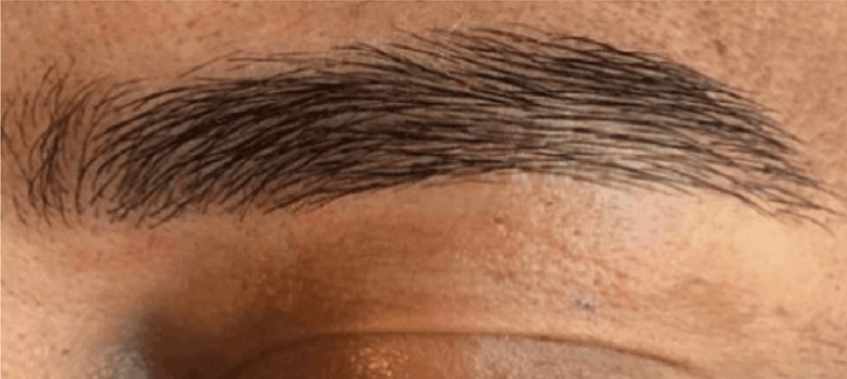 Before BrowBro